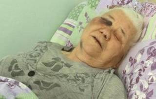 Избитая в Павлодаре пенсионерка теряет зрение