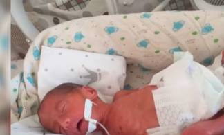 Новорожденный лишился носа в перинатальном центре в Актау