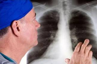Количество смертей от болезней органов дыхания в Мангистауской области подскочило сразу в 2,3 раза за год