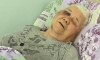 Избитая в Павлодаре пенсионерка теряет зрение