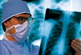 Заболеваемость туберкулезом в Казахстане снизилась в 2,3 раза
